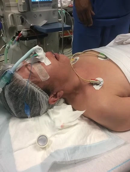 chirurgie de la thyroïde 6