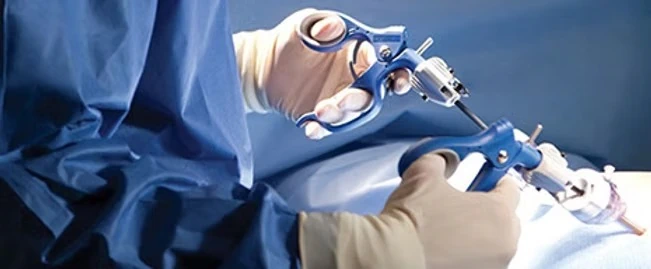 vésicule biliaire Docteur Deroide Paris